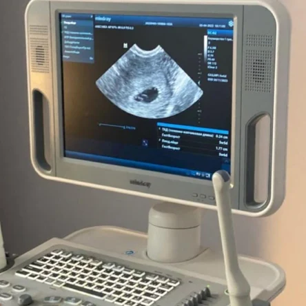 УЗИ диагностика беременности